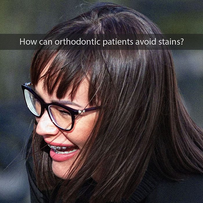 orthodontic stains 2022 700 Wheeler Orthodontics